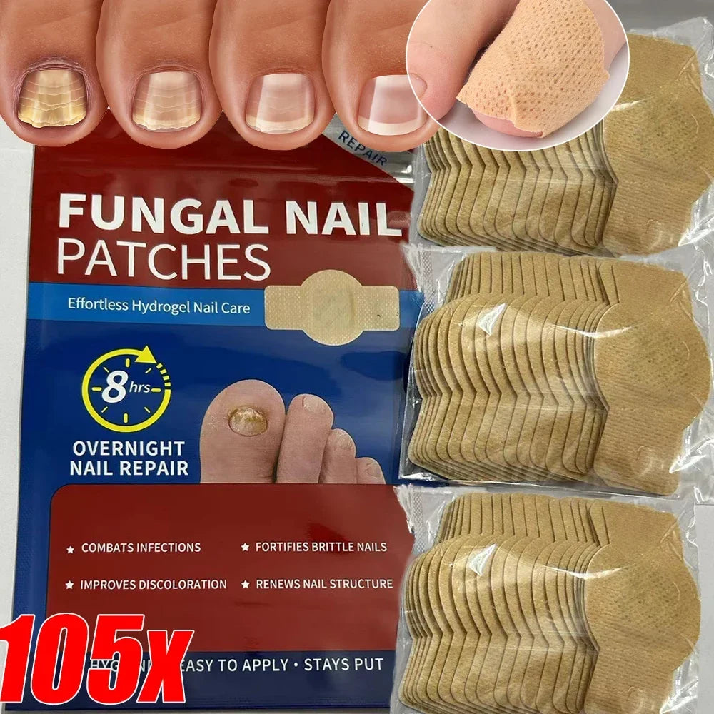 Nail Repair Patches – Toenail Care & Ingrown Correction Stickers