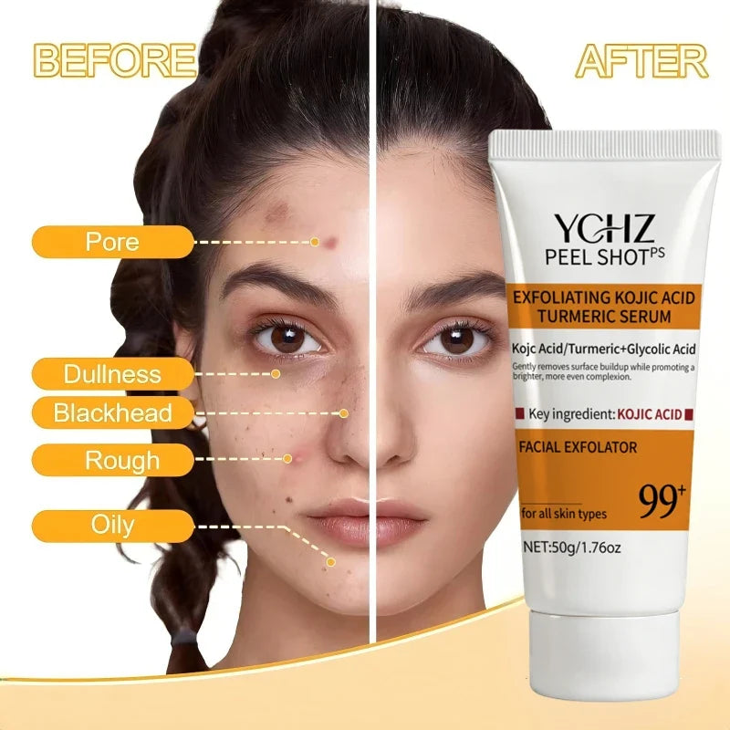 Turmeric Kojic Acid Exfoliating Gel – Face & Body Scrub 50g
