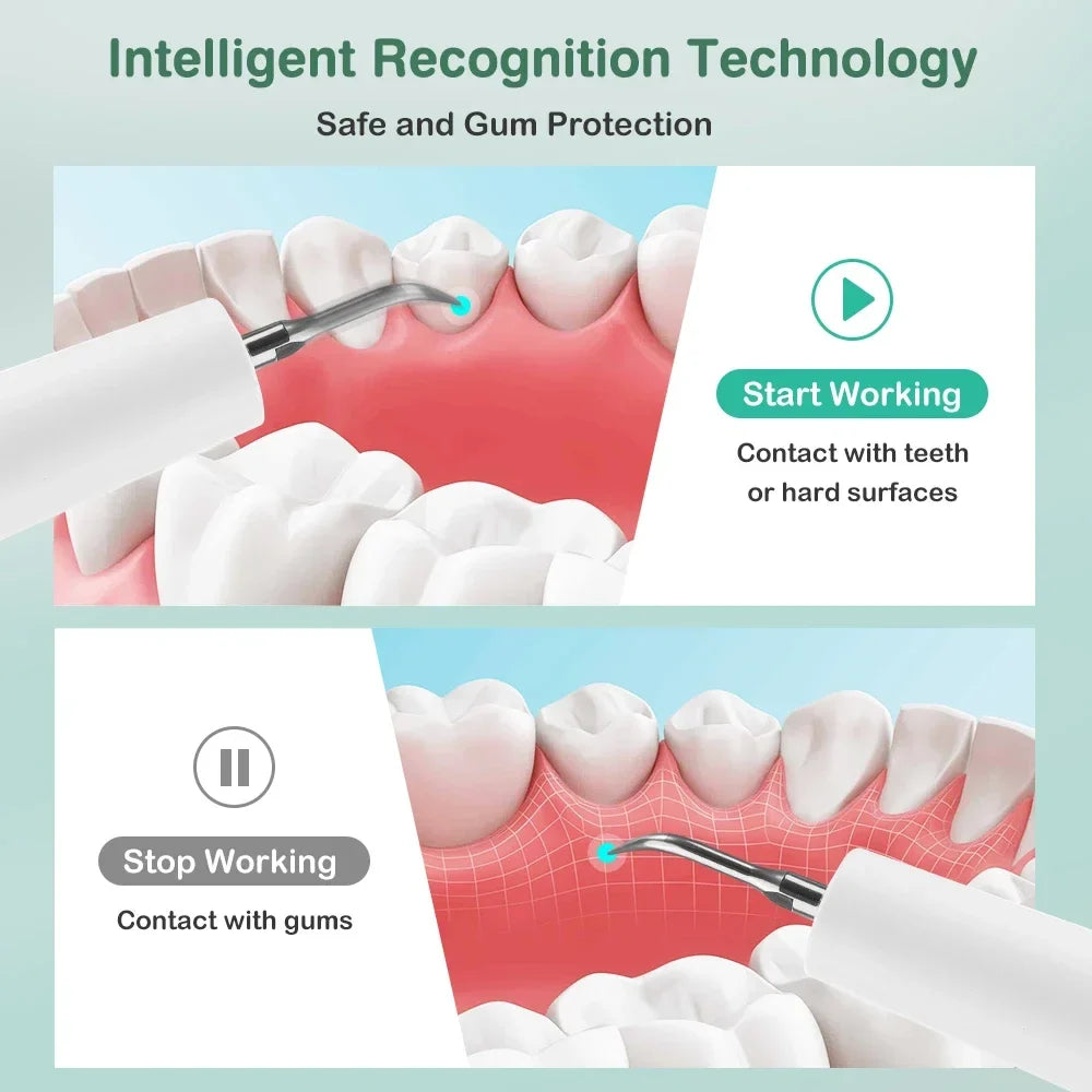 AFDEAL Ultrasonic Dental Scaler – 5 Modes, 9 Levels, LED Light