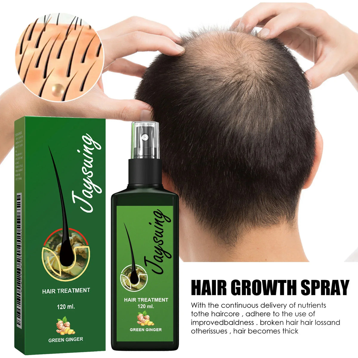Ginger Hair Growth Serum Spray – Anti Hair Loss Scalp Treatment