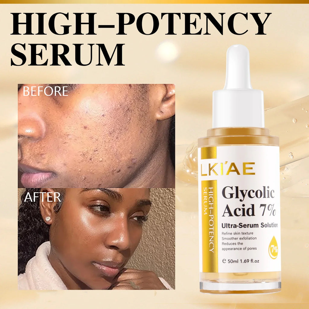 AILKE Brightening Face Serum | Niacinamide & Glycolic Acid 50ml