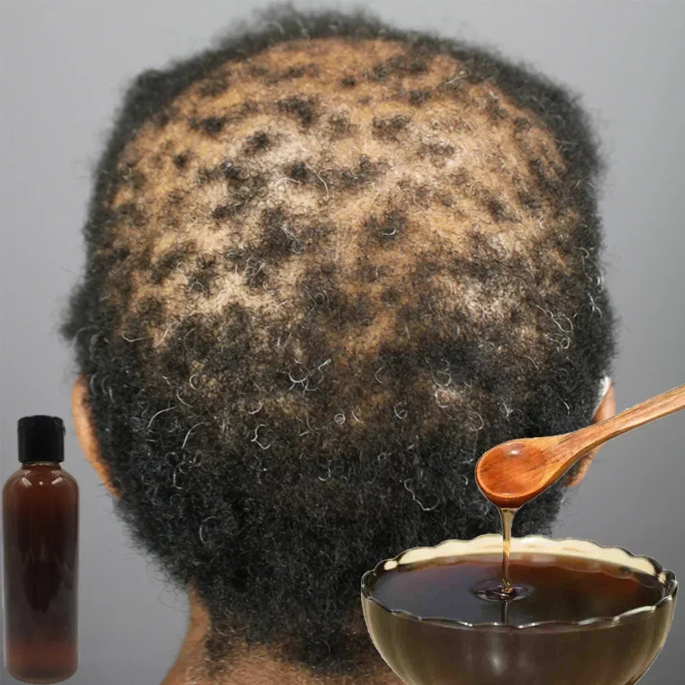 Herbal Hair Growth Shampoo 300ml – Ginseng & Botanical Blend