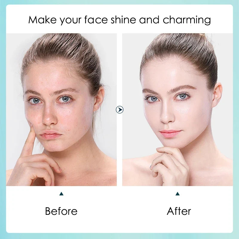 BIOAOUA Hyaluronic Acid Sheet Mask 10pc | Hydrate & Shrink Pores
