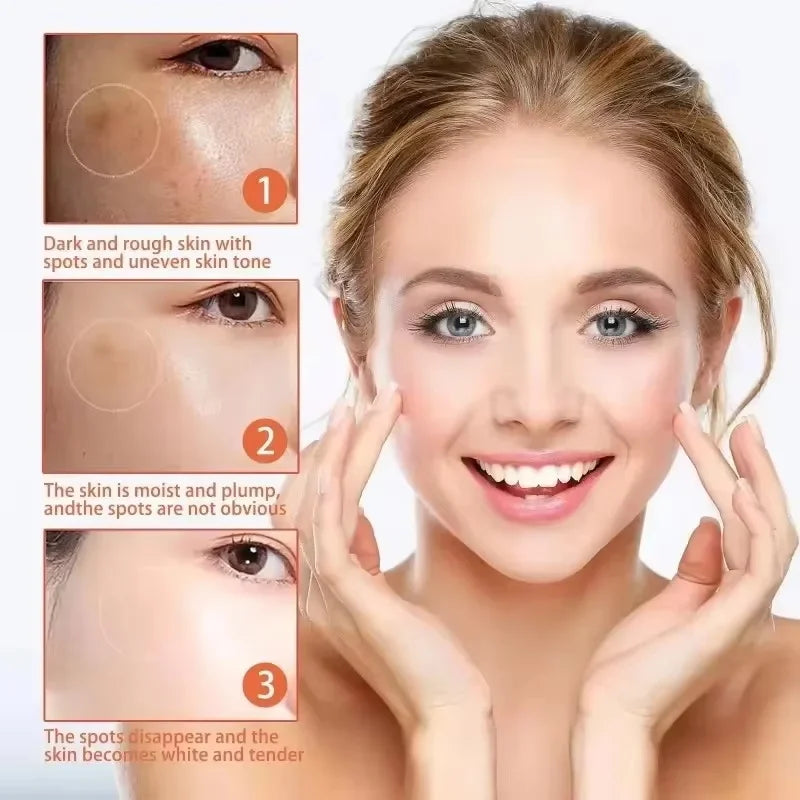 Niacinamide Dark Spot Brightening Cream – Even Skin Tone 30ml