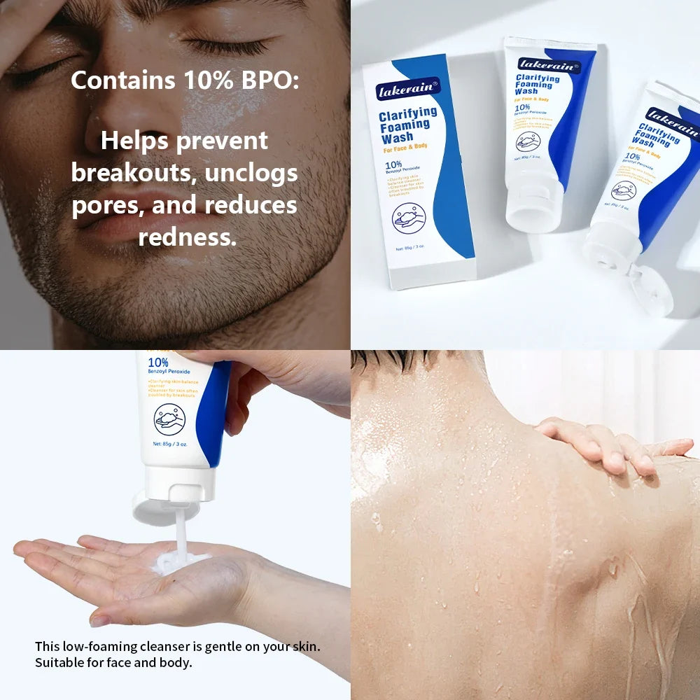 10% Benzoyl Peroxide Foaming Face & Body Wash | Oil Control