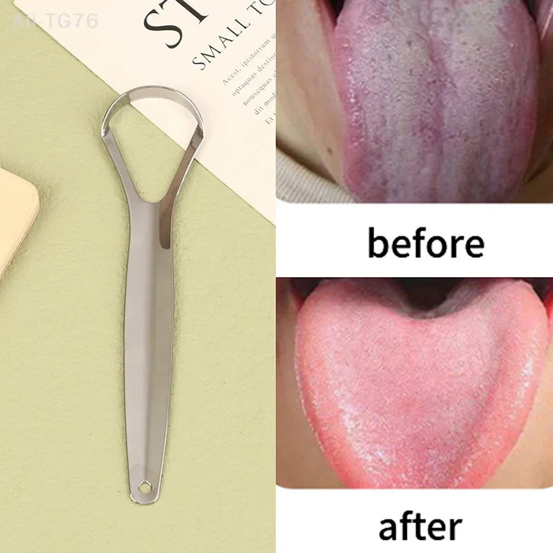 Stainless Steel Tongue Scraper | Fresh Breath Dental Tool