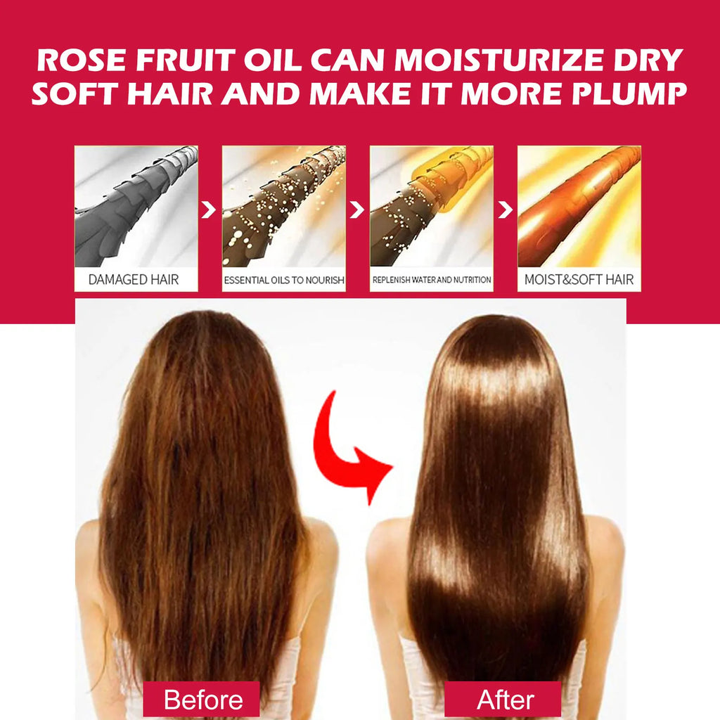 EELHOE Rosehip Facial Oil – Firming, Anti-Aging & Brightening