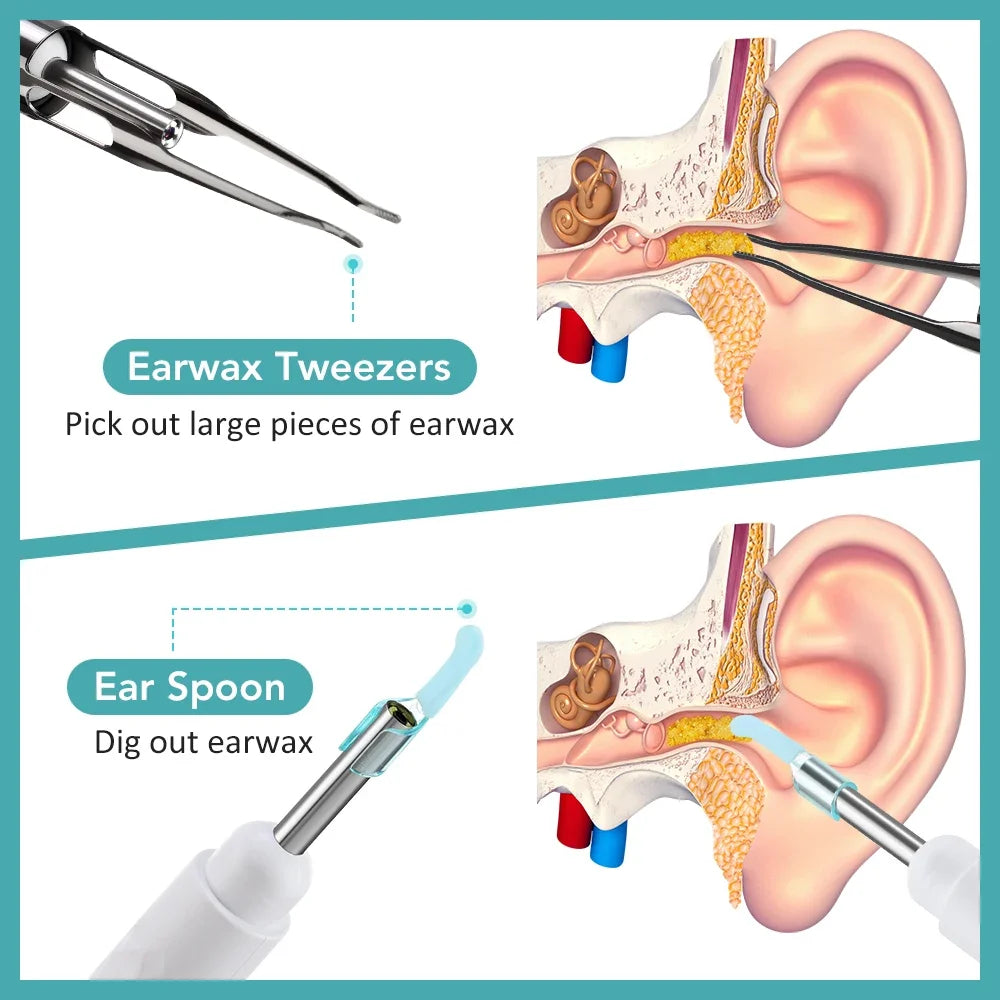 Visual Ear Cleaner with 1080P Camera & Tweezers | All Ages