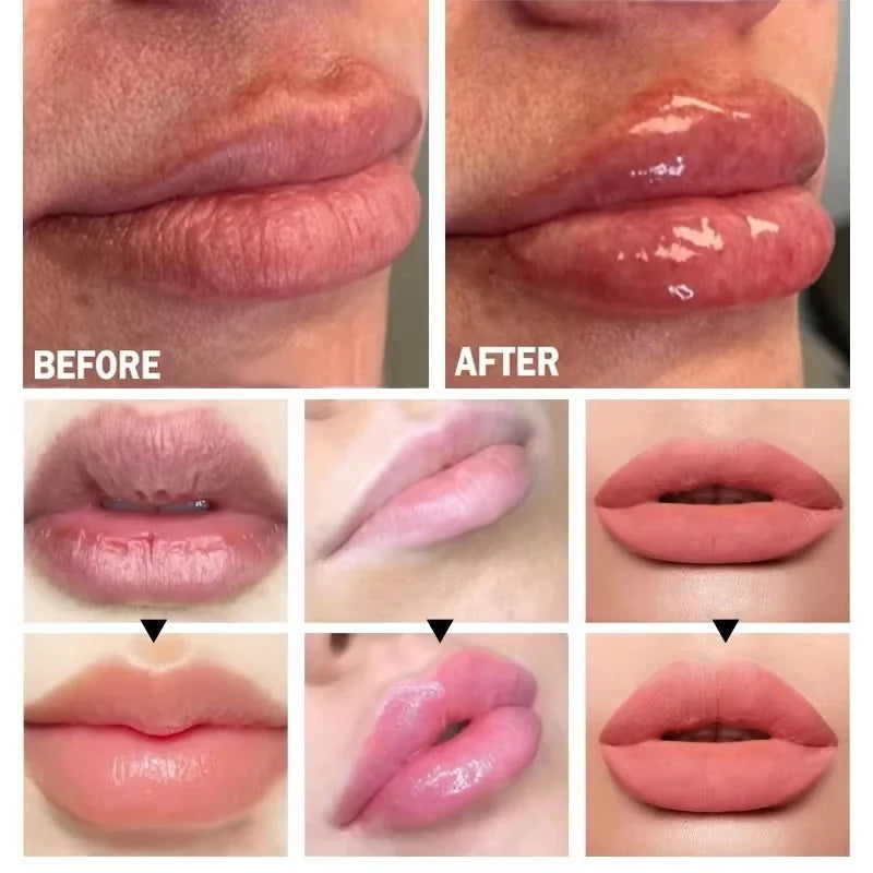Eelhoe Lip Plumper Oil – Volumising, Moisturizing & Nourishing