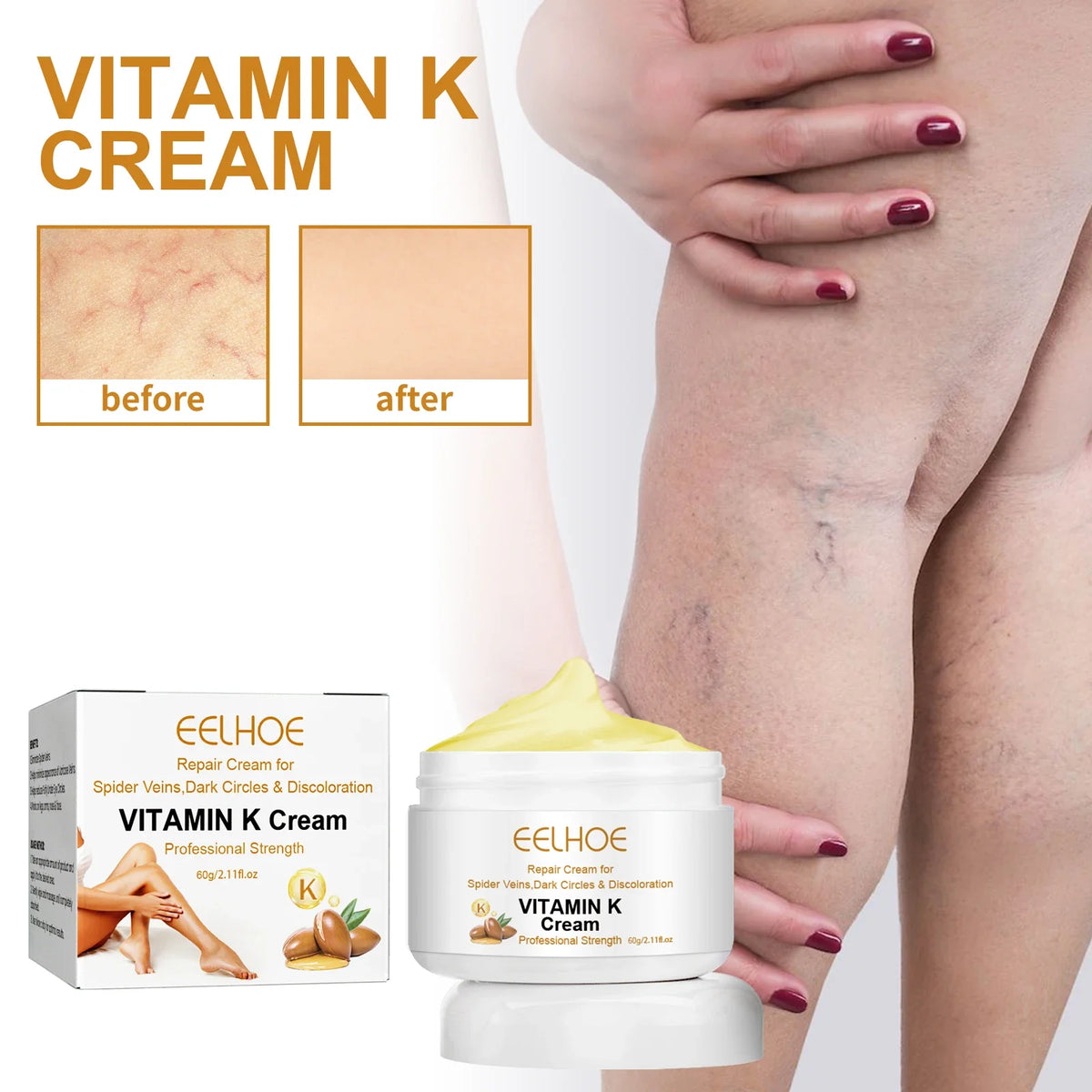 Eelhoe Vitamin K Cream – Vein Appearance & Even Skin Tone 60g