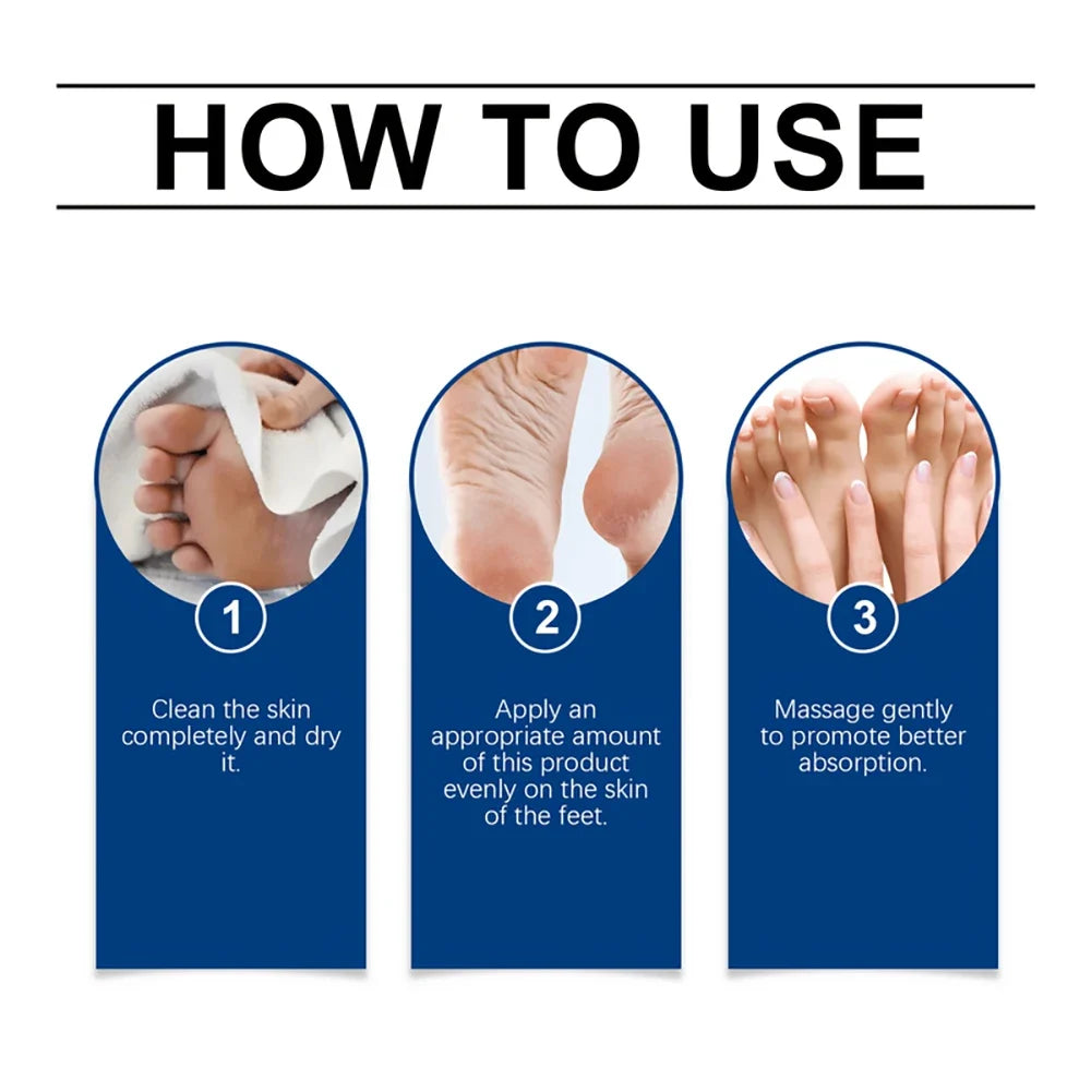 SUYARUN 60% Urea Foot Cream – Cracked Heels & Dry Skin