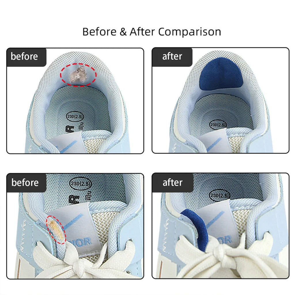 6-Pack Inside Shoe Repair Patches – Velvet Multi-Color Fix Kit