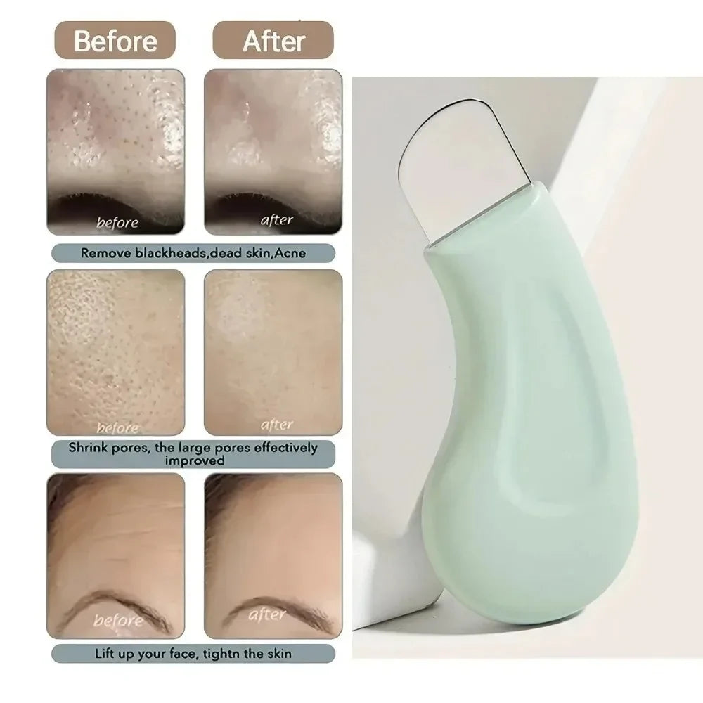 Silicone Blackhead Removal Facial Scrub Scraper | Pore Cleaner