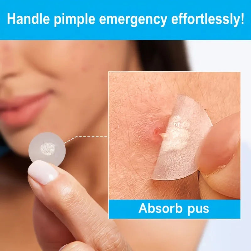 Hydrocolloid Acne Patches Bulk Pack | 108–432 Count