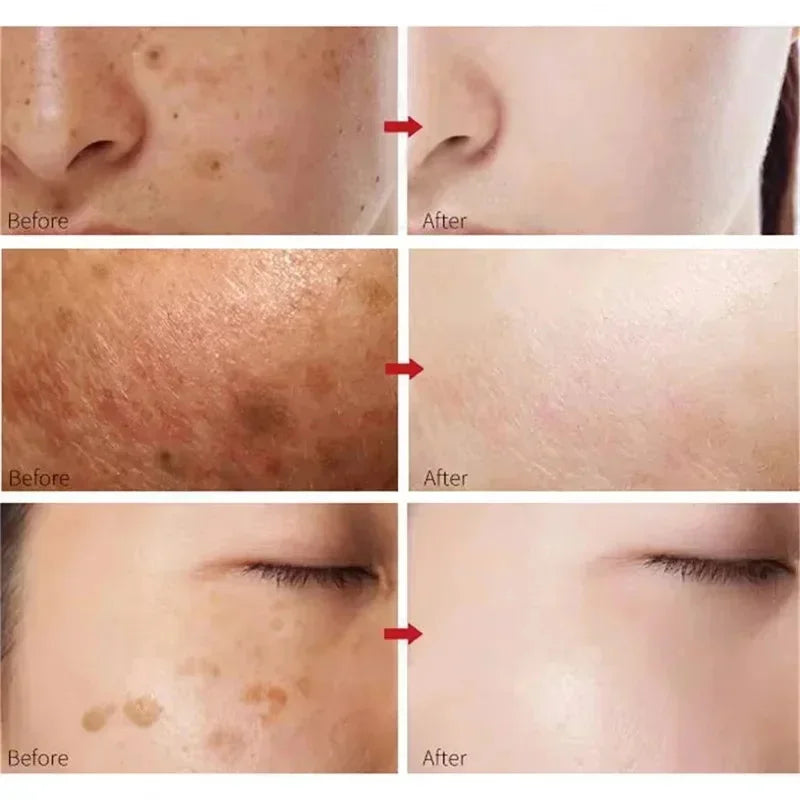 Kojic Acid Brightening Serum – Dark Spot & Tone Corrector