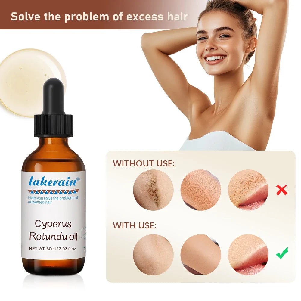 Cyperus Rotundus Hair Growth Inhibitor Oil 60ml | All Skin Types
