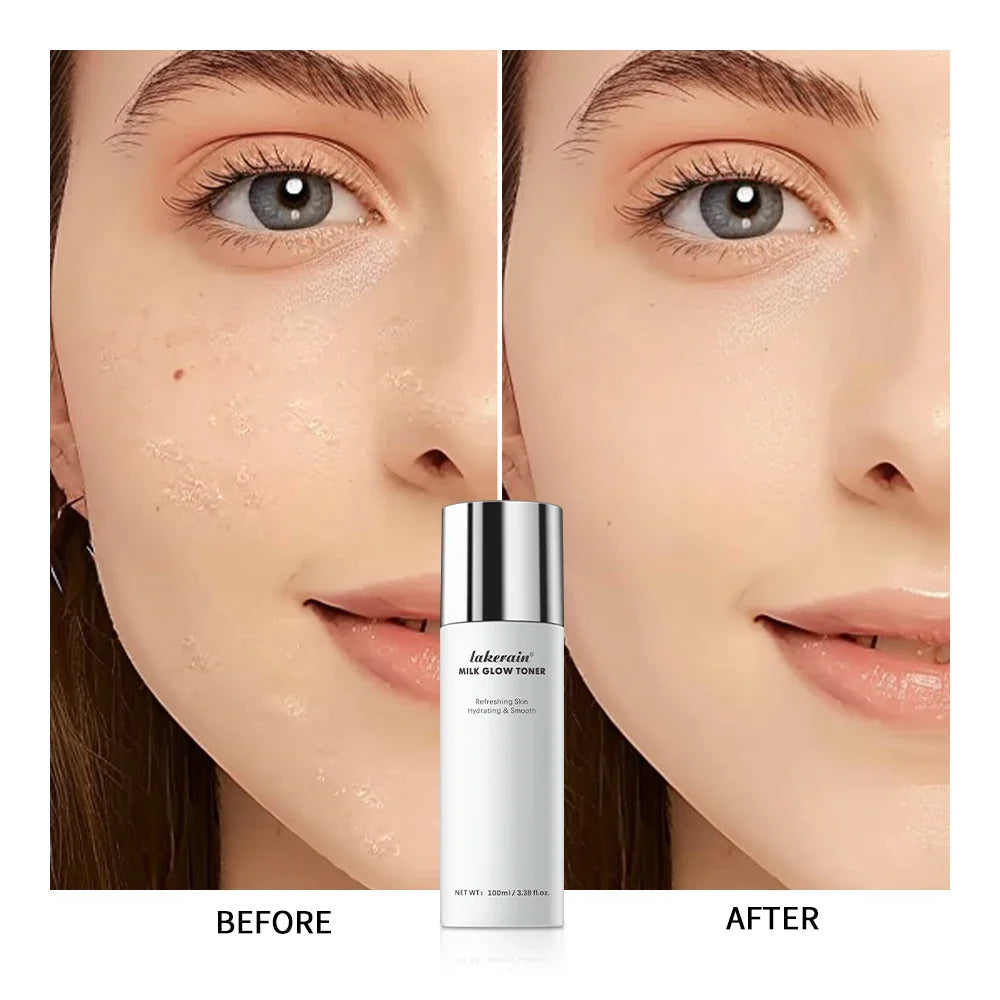 Milk Soothing Facial Toner – Niacinamide & Houttuynia Extract