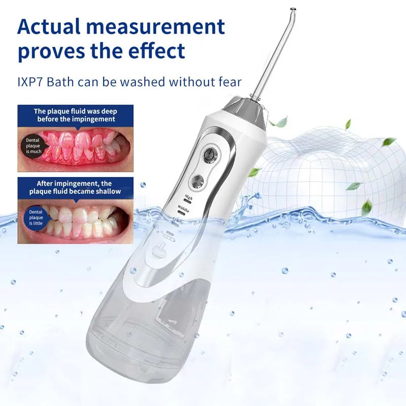 Portable Water Flosser 300ml USB Rechargeable Oral Irrigator