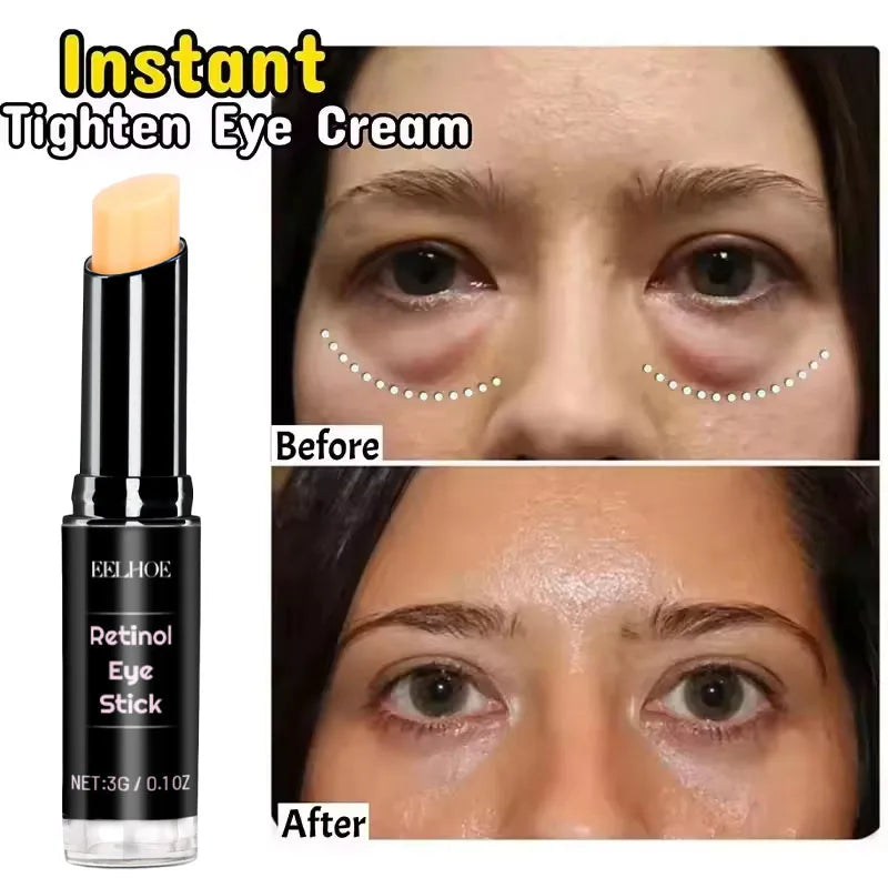 Eelhoe Retinol Eye Cream Stick – Firm, Brighten & Hydrate
