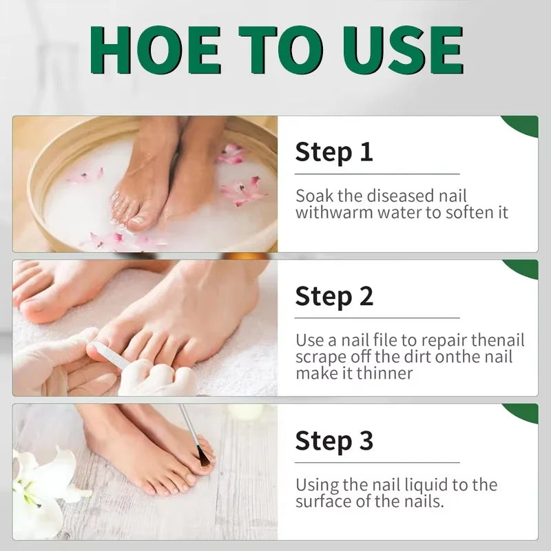 Ginger Nail Repair Serum – Restore Discolored & Uneven Nails