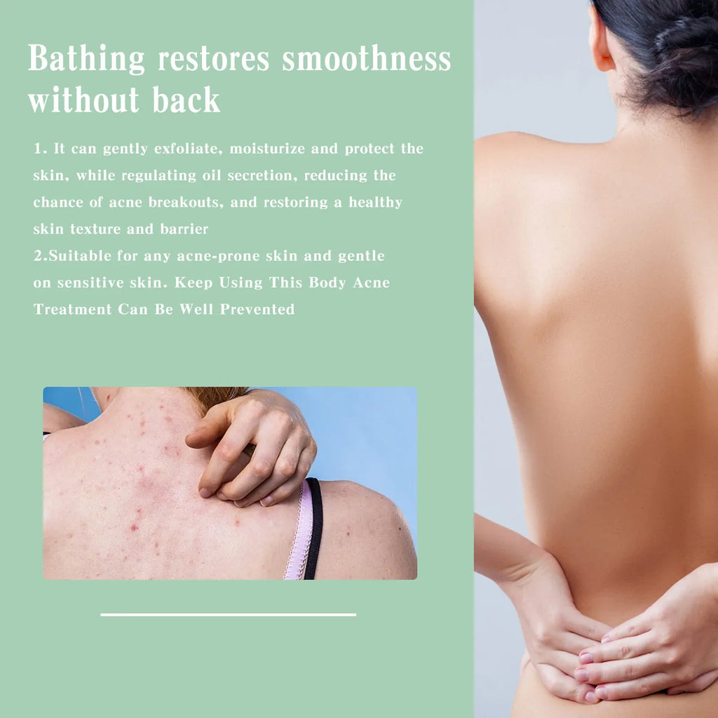 Eelhoe Back & Body Acne Repair Spray | Pore & Oil Control