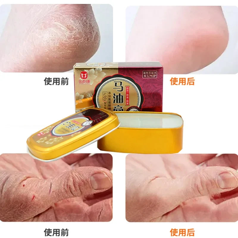 Jintai Kangma Horse Oil Cream – Hand & Foot Moisturizer 80g
