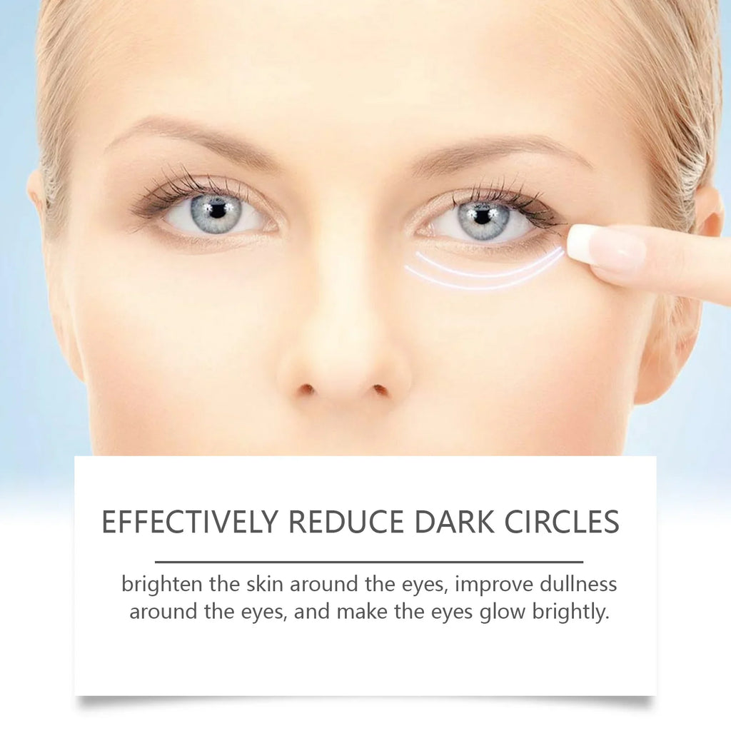 Hoygi Nicotinamide Eye Cream – Dark Circles & Firming 20g