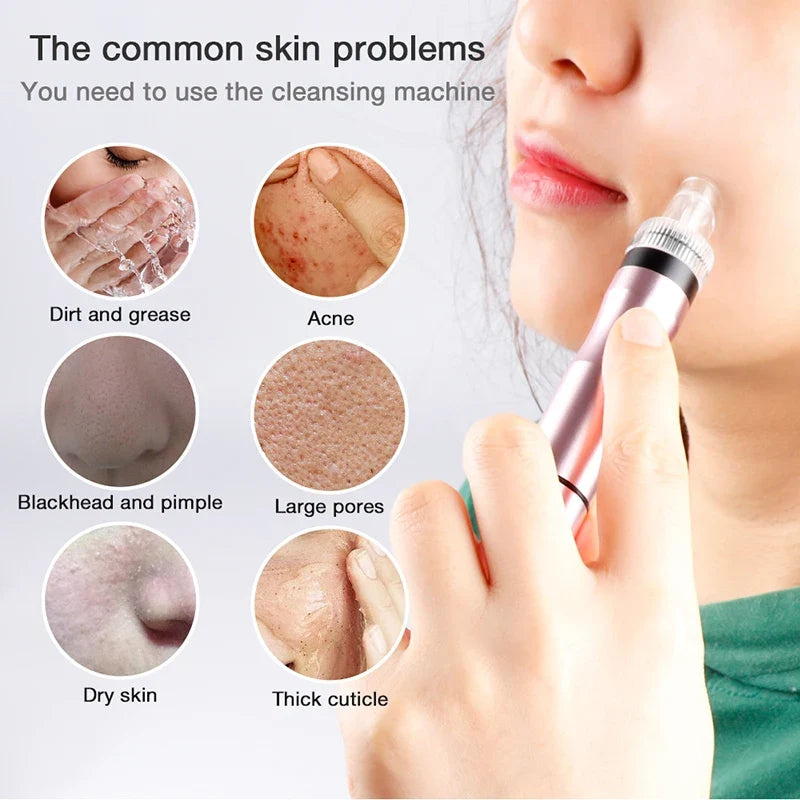 Mini Water Jet Facial Cleansing Machine – Pore & Skin Care