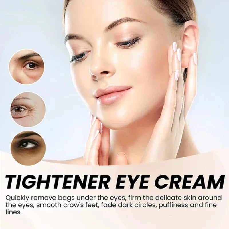 Retinol Eye Cream – Dark Circles, Fine Lines & Wrinkles