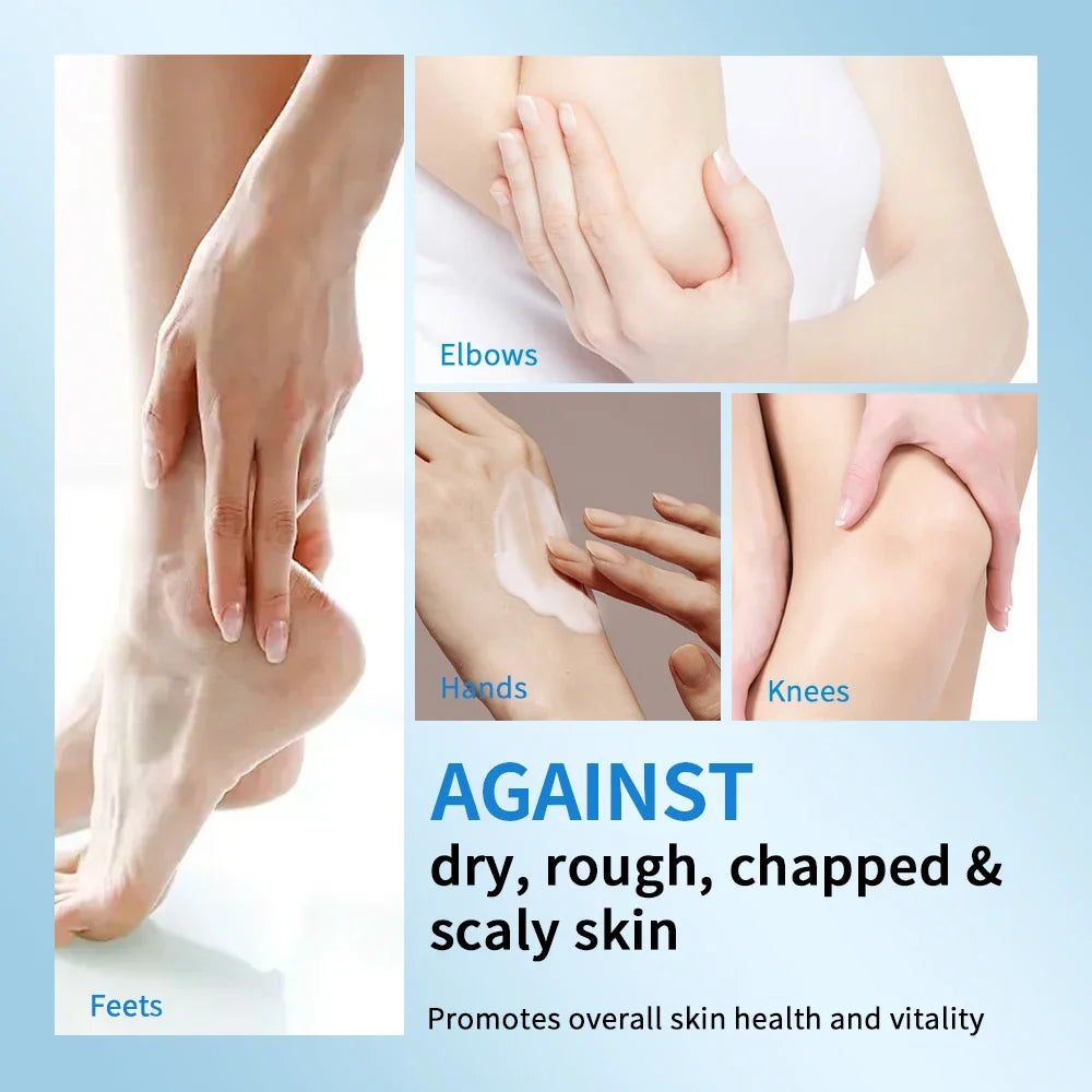 40% Urea Cream + 2% Salicylic Acid Foot & Hand Moisturizer