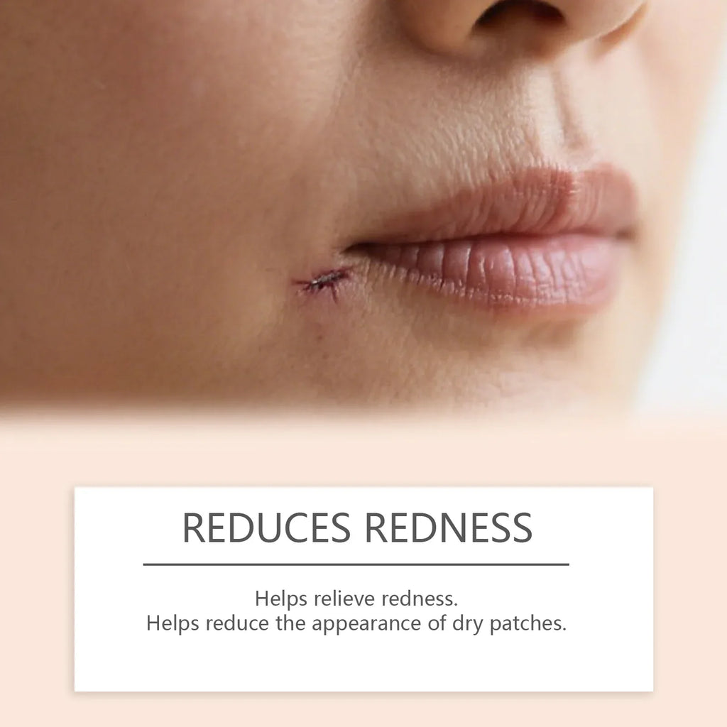 Silicone Scar Stick Acne Reducing Redness Repair Blemishes Mild