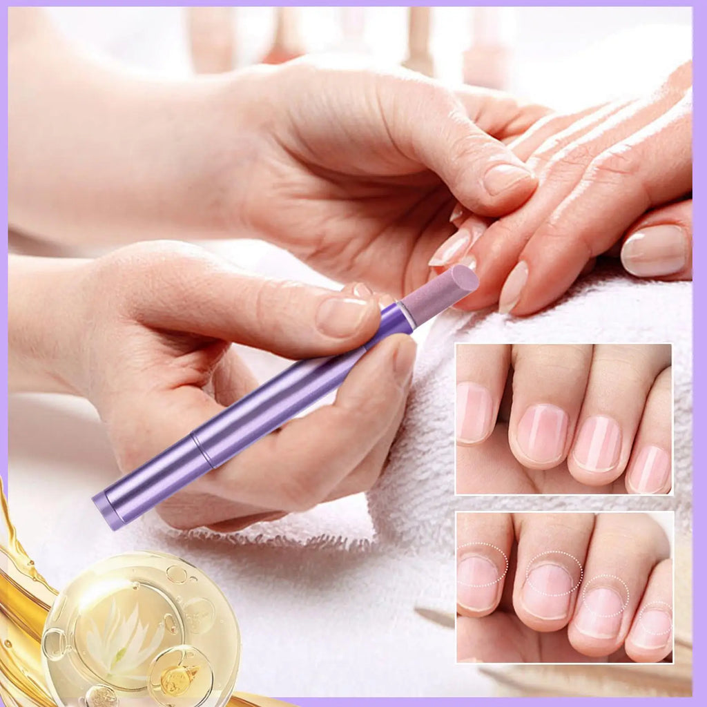 Cuticle Oil Pen – Ceramic Tip Nail Care Tool for Women