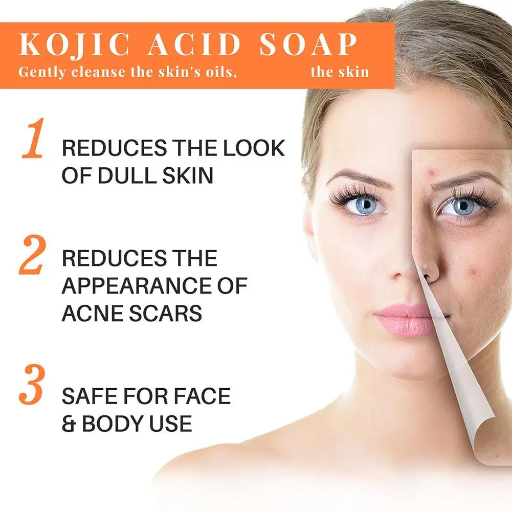 Kojic Acid Soap – Brightening, Acne & Dark Spot Remover Bar