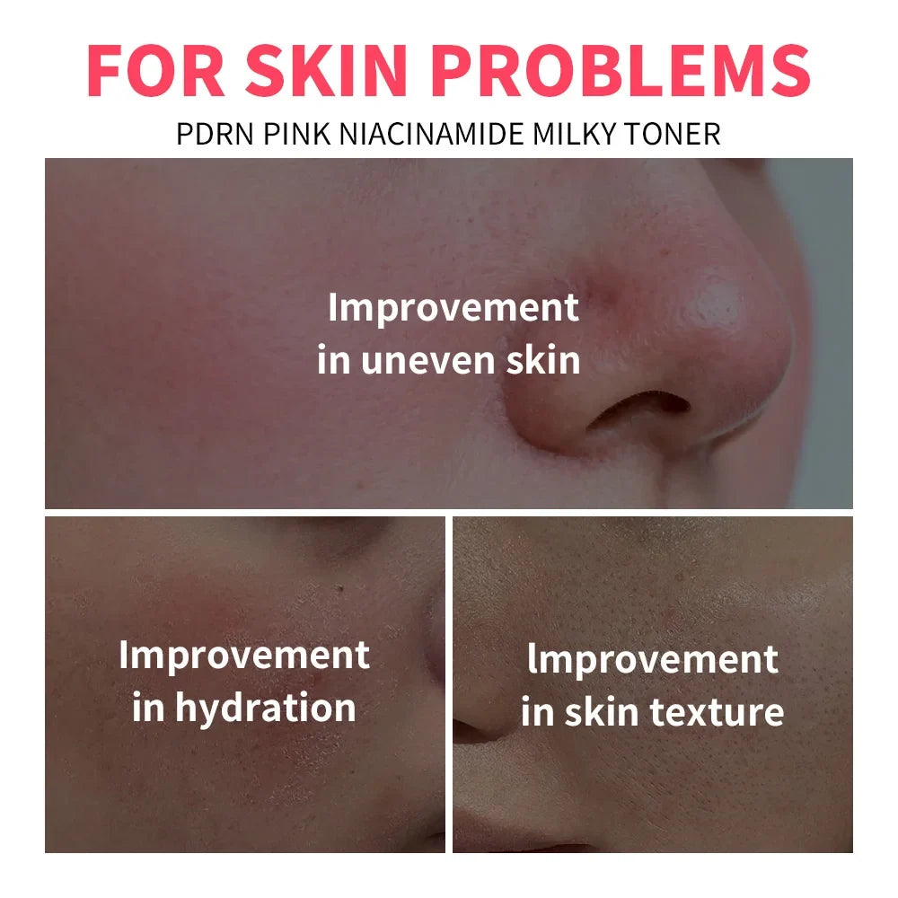 PDRN Niacinamide Milky Toner – Deep Hydration & Glow 100ml
