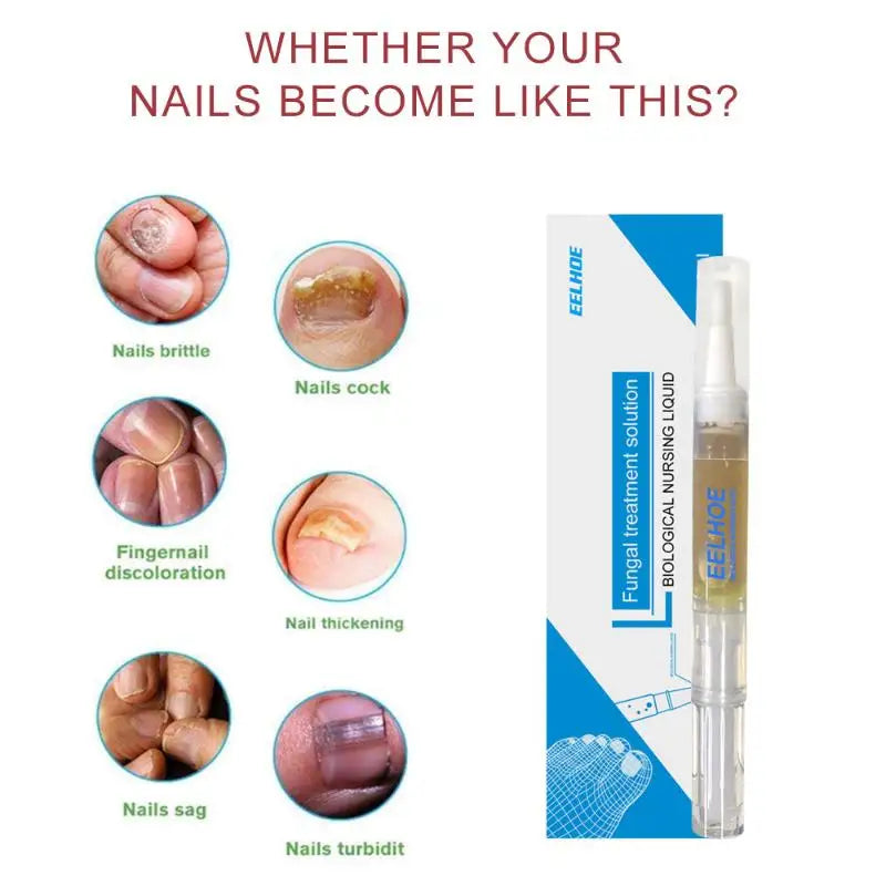 Nail Brightening & Cleansing Solution – Tea Tree & Jojoba 3ml
