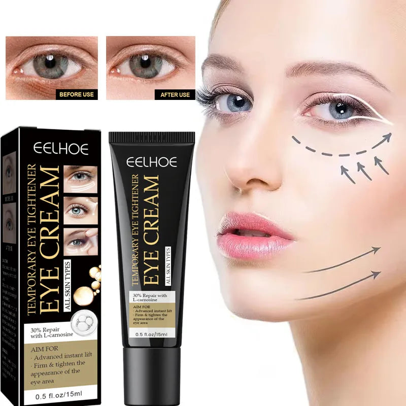 Retinol Eye Cream – Firming, Dark Circle & Hydrating 15ml