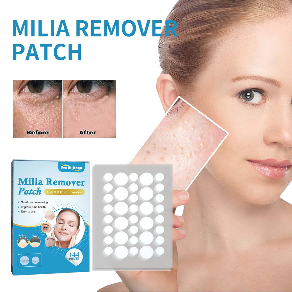 South Moon 144pc Hydrocolloid Blemish Patches | Salicylic & Cica