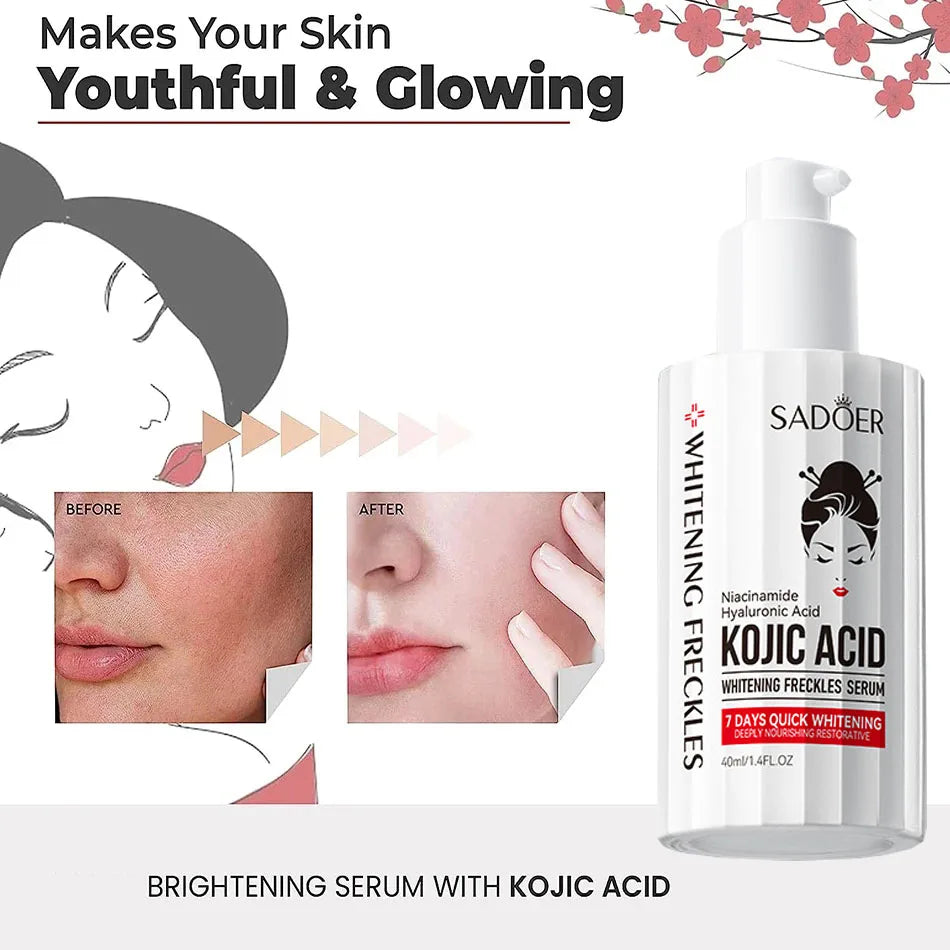 Kojic Acid Serum Strong Brightening Whitening Cream Spots Fine Lines