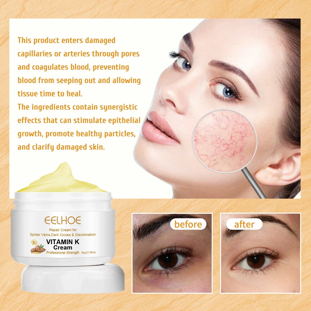 Eelhoe Vitamin K Cream – Vein Appearance & Even Skin Tone 60g