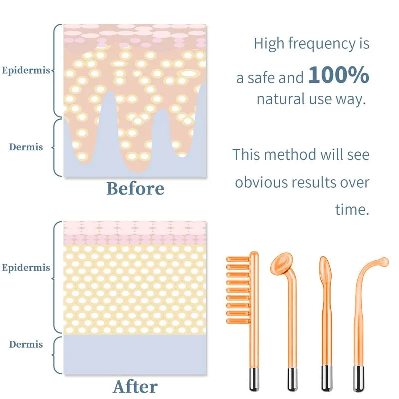 High Frequency Electrotherapy Skin Device | Pro-Grade Wand
