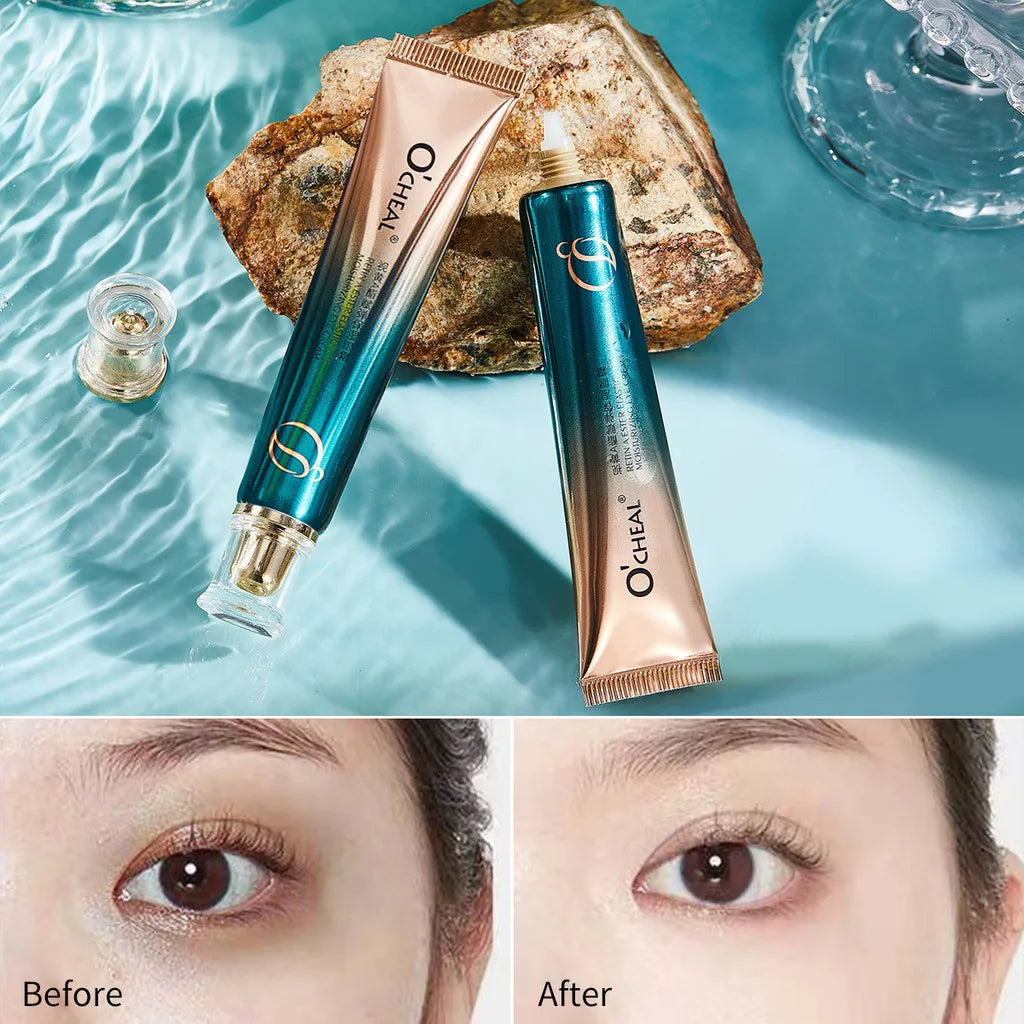Retinol A Eye Cream – Firming, Brightening & Moisturizing 30g