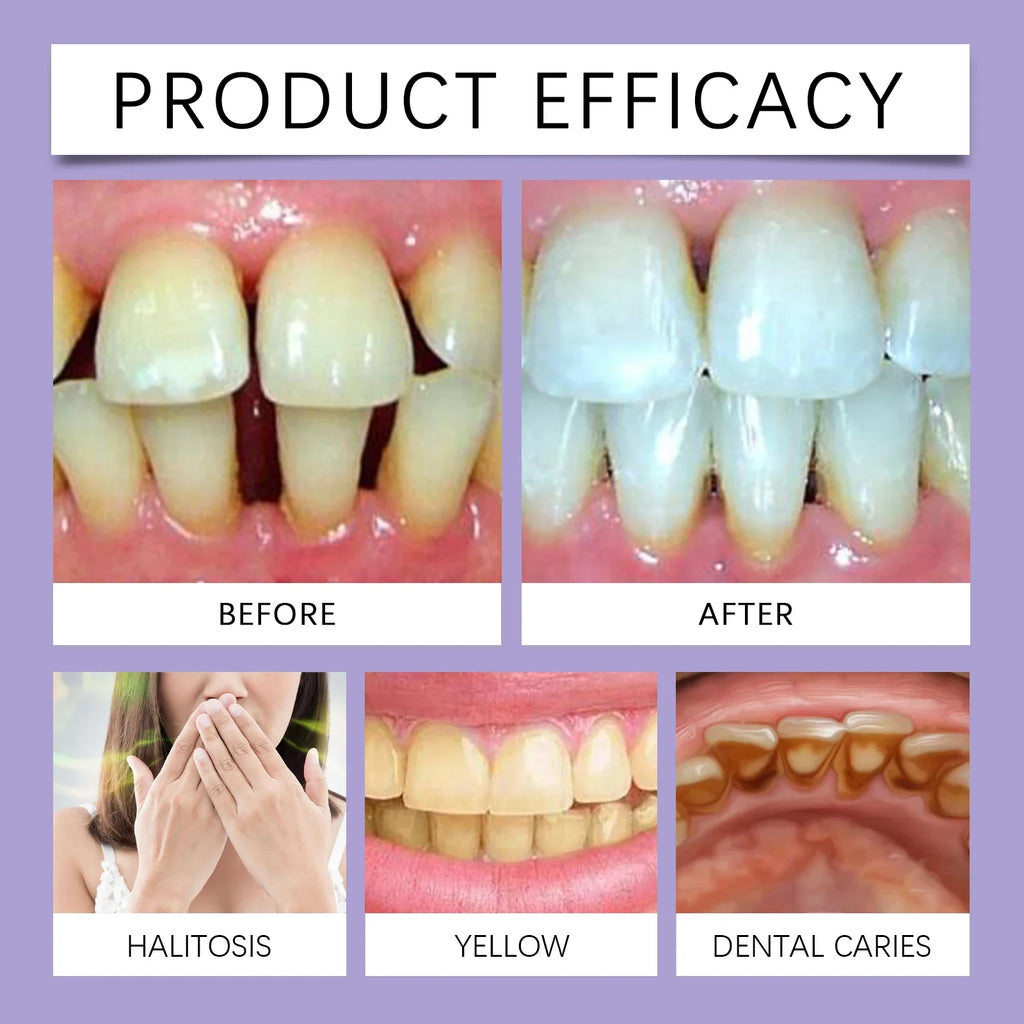 Purple Teeth Brightening Strips | Stain Removal Oral Care 7pcs