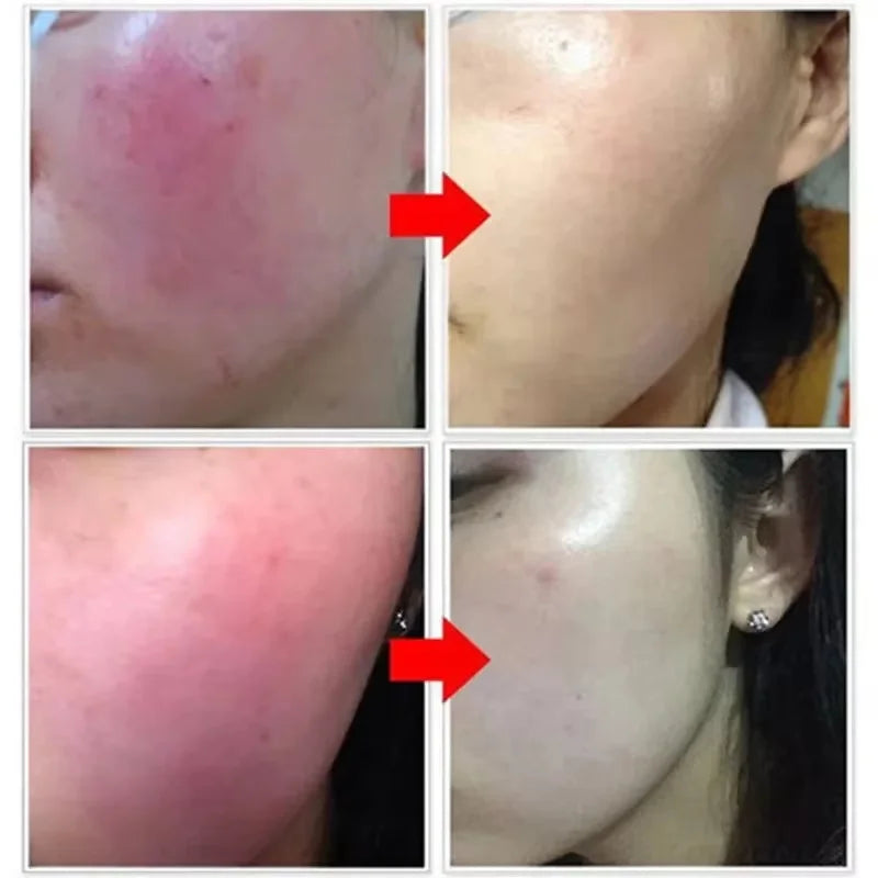 SADOER Calming Face Serum – Sensitive Skin & Pore Minimizer