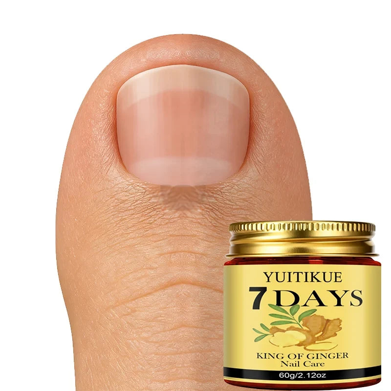 YUITIKUE Ginger King Nail Care Cream – 7-Day Results | 60g