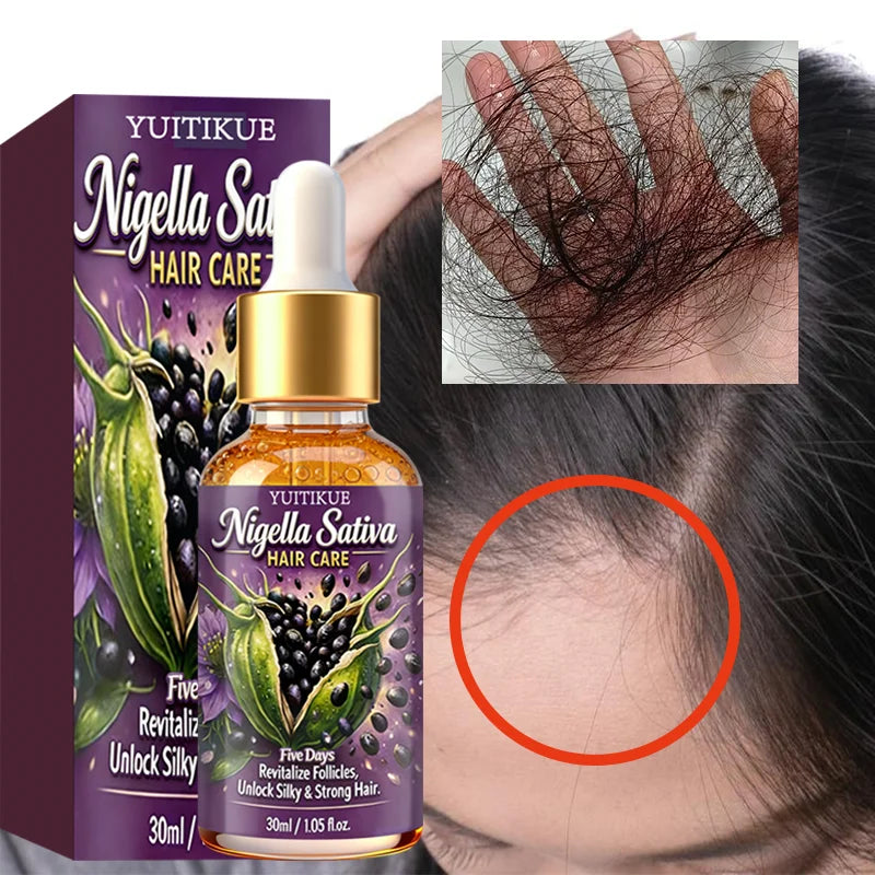 YUITIKUE Nigella Sativa Hair Oil – Scalp & Strengthening Oil