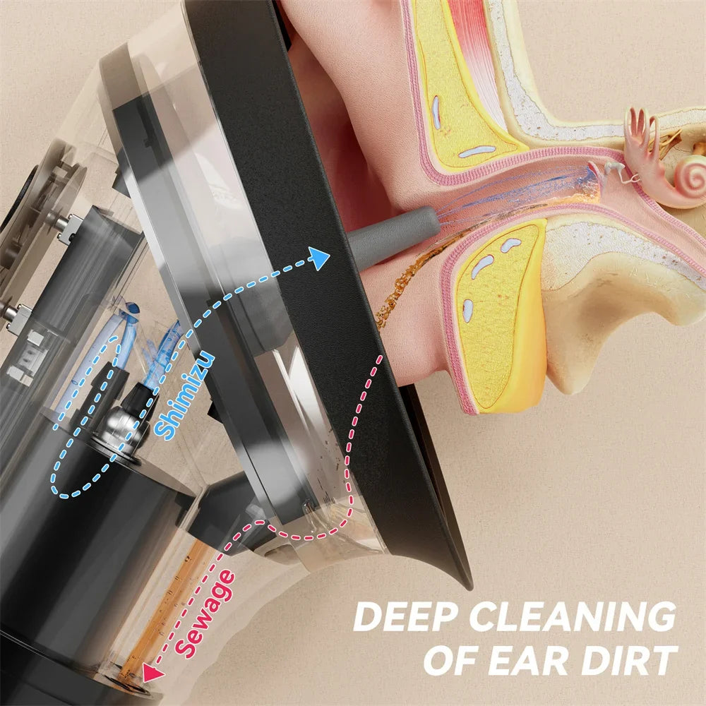 Electric Ear Wax Removal System – Water Irrigation Flusher