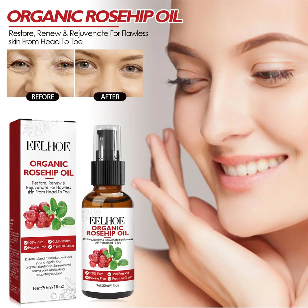 EELHOE 30ml Organic Rosehip Oil Face Serum – Hydrating & Firming
