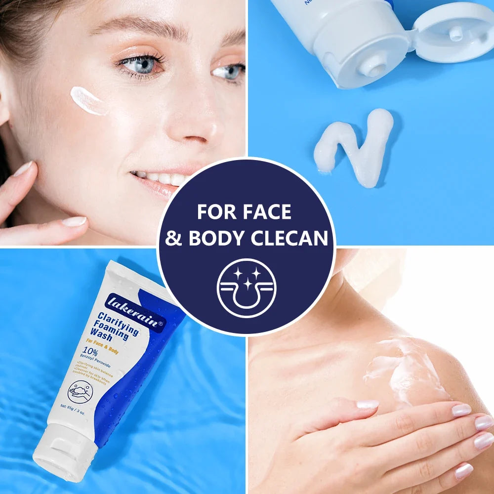 10% Benzoyl Peroxide Foaming Wash – Face & Body Cleanser