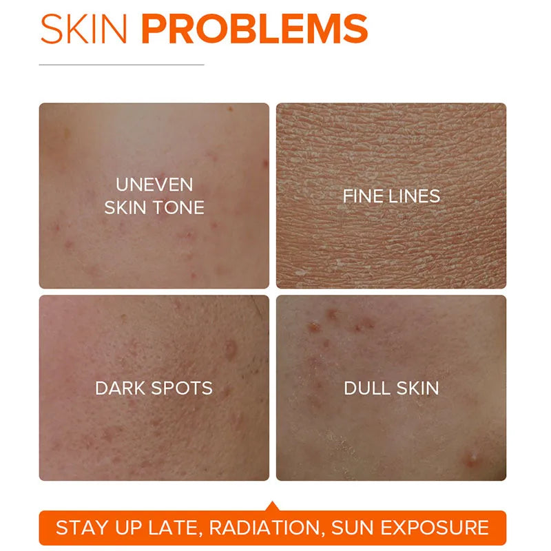 LAIKOU Vitamin C Facial Cream Delicate Hydrating Moisturising Skin