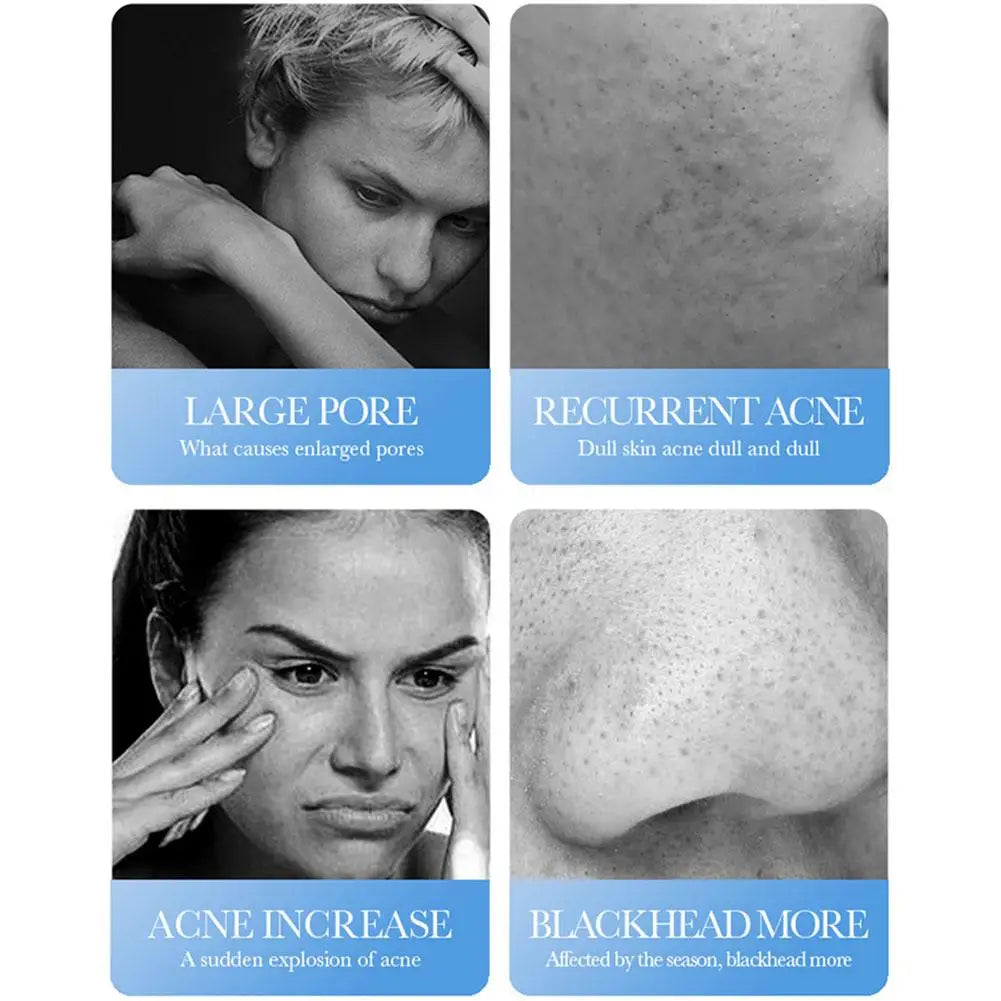 BIOAQUA Salicylic Acid Acne Cream – Pore Minimizer & Oil Control